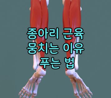 종아리 근육 뭉침 원인 푸는법