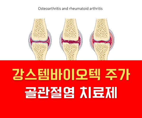 강스템바이오텍 주가 골관절염 치료제