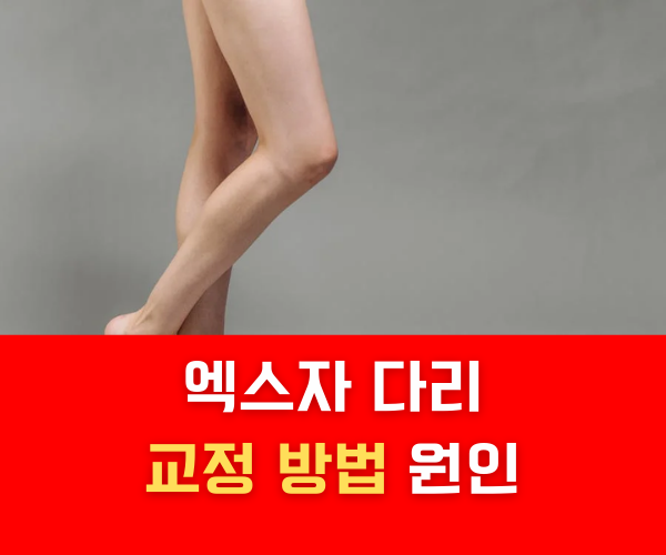 엑스자 다리 교정 방법 원인